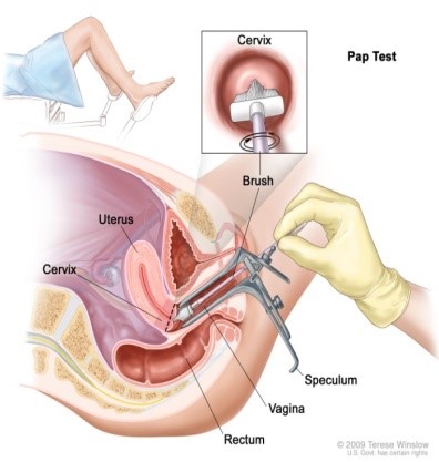 Timing of Pap Smear